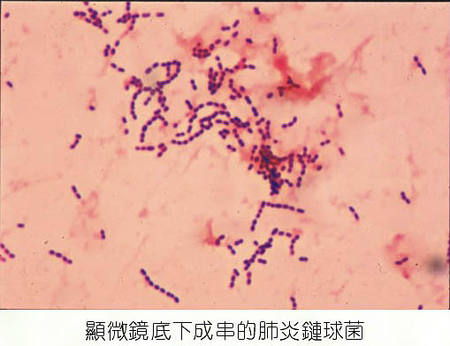 【台灣】流感季節報到 小心肺炎鏈球菌病毒發威