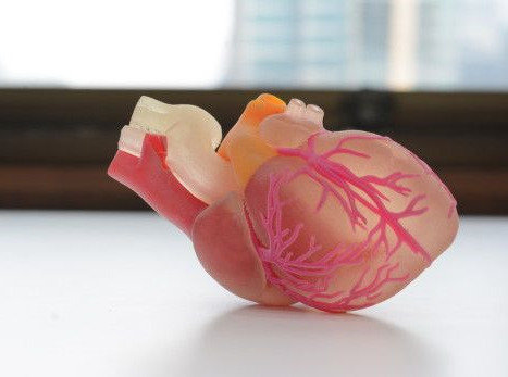 3D打印改變醫療局限
